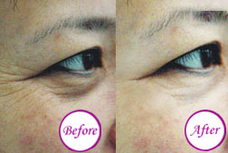 膠原蛋白抗衰老真人真事?